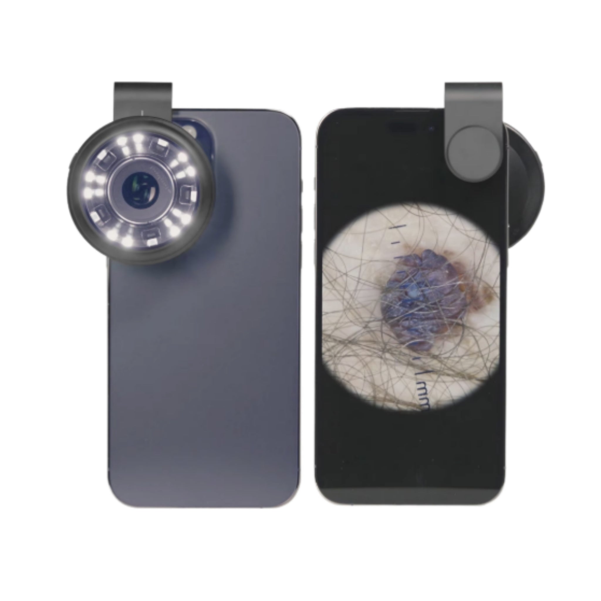 10X Electric Magnifying Camera Dermatoscope for Scalp and Hair Loss Detection - Polarized